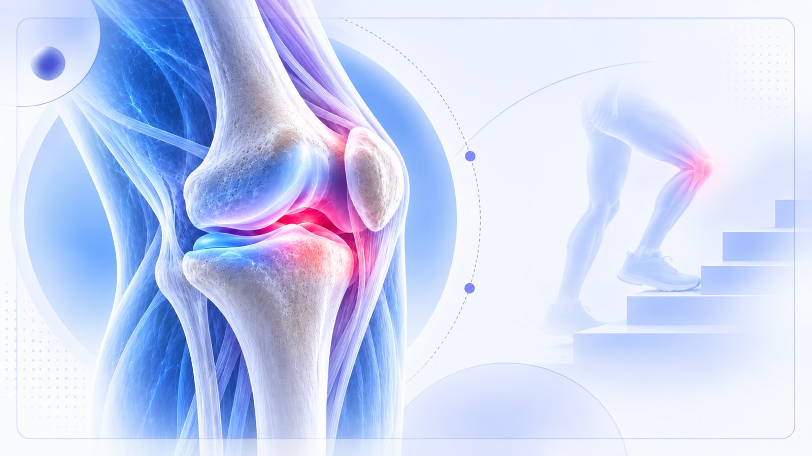 Knee Pain on Stairs Should Not Be Ignored